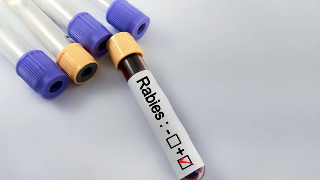 Blood test vial with rabies sticker and empty vials